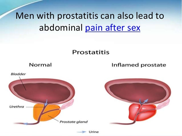 After in pain sex stomach